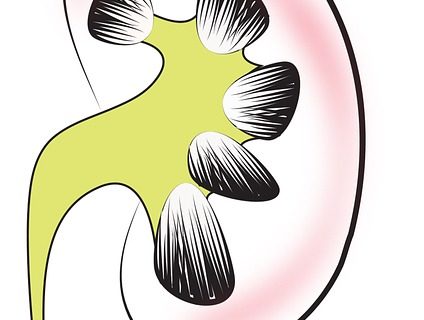 Harnsäure senken – Tipps zur richtigen Senkung der Harnsäure