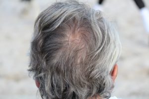 Hausmittel gegen graue Haare – was hilft?