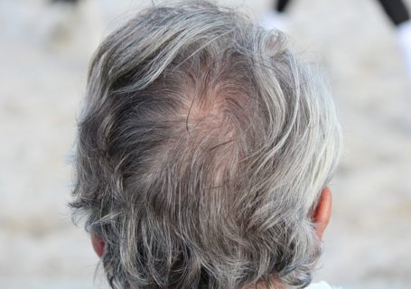 Hausmittel gegen graue Haare – was hilft?